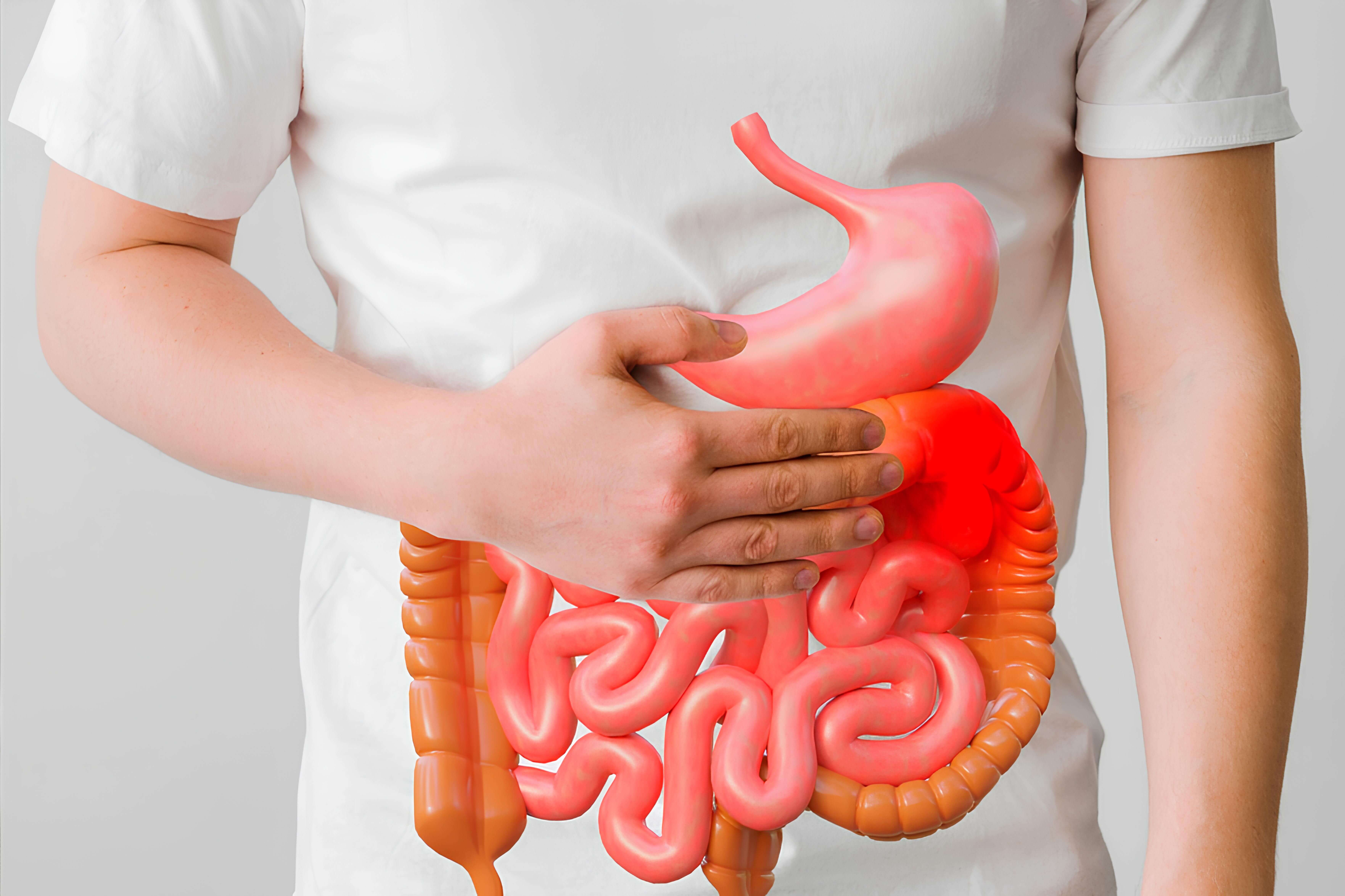 Crohn S Disease Crohn S Disease